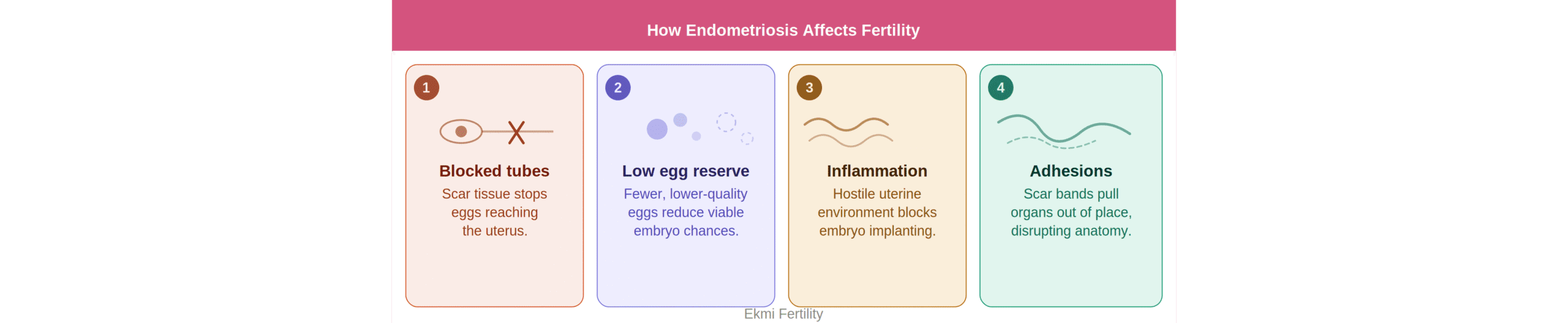 Four ways the condition quietly interferes with conception