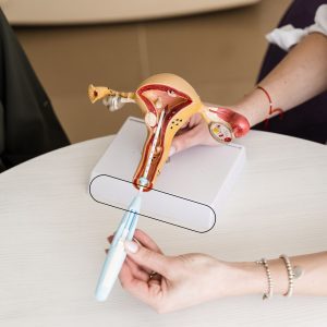Intrauterine insemination (IUI) Treatment