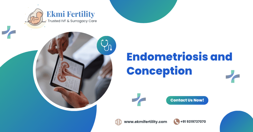 Endometriosis and conception